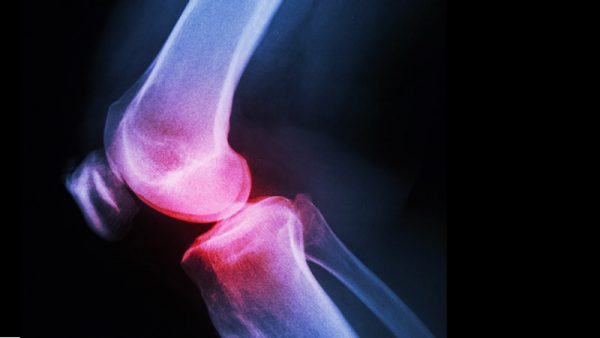 Orthopaedic Specialties - Knee Injuries or problems
