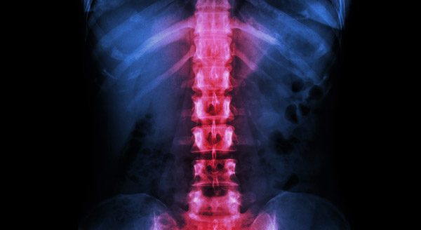 Orthopaedic Specialties - Spine Injuries or problems
