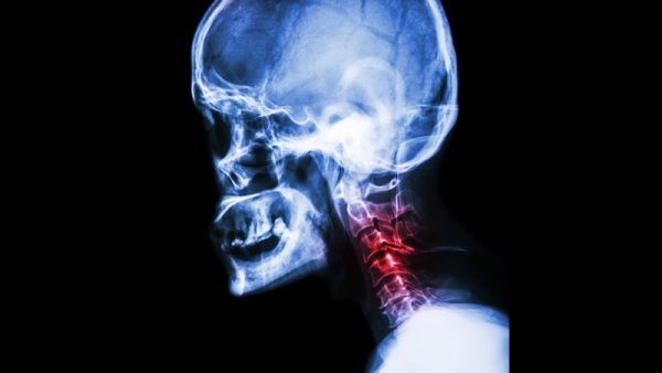 Orthopaedic Specialties - Trauma Injuries or problems
